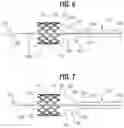 Fig. 06 - PROSTHETIC VALVE DELIVERY ASSEMBLY