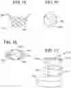 Fig. 28 - Collapsible inner flow control component for side-deliverable transcatheter heart valve prosthesis