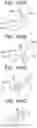 Fig. 40 - Collapsible inner flow control component for side-deliverable transcatheter heart valve prosthesis