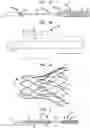 Fig. 02 - System to assist in the release of a collapsible stent from a delivery device