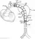 Fig. 01 - Delivery catheter for endovascular device