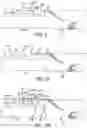 Fig. 06 - Delivery catheter for endovascular device