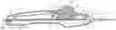 Fig. 01 - Rotary handle stent delivery system and method