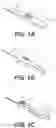Fig. 02 - Rotary handle stent delivery system and method