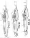 Fig. 07 - Rotary handle stent delivery system and method