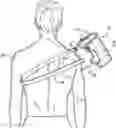 Fig. 01 - BRACE TO COVER ATROPHY IN THE SHOULDER