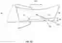 Fig. 06 - VARIABLE DENSITY ORTHOSIS
