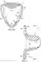 Fig. 09 - External penile prosthesis for augmenting male potency
