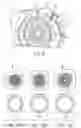 Fig. 06 - Ostomy appliance configured for leakage detection