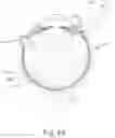 Fig. 07 - Guide apparatus for tangential entry into suprachoroidal space