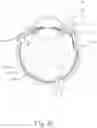 Fig. 08 - Guide apparatus for tangential entry into suprachoroidal space