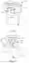 Fig. 22 - Guide apparatus for tangential entry into suprachoroidal space