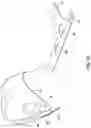Fig. 09 - HEAD TRAUMA BANDAGE CAP