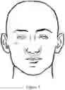 Fig. 02 - NASAL COMPRESSION DEVICE