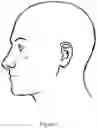 Fig. 03 - NASAL COMPRESSION DEVICE