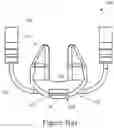Fig. 04 - NASAL COMPRESSION DEVICE
