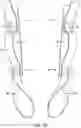 Fig. 10 - Rescue strap for carrying a patient