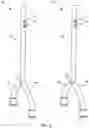 Fig. 04 - Stair assist cane