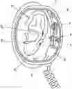 Fig. 01 - STIMULATION METHOD, IN PARTICULAR LASER ACUPUNCTURE