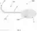 Fig. 06 - Systems, apparatus, and methods for placing a guidewire for a gastrostomy tube