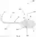 Fig. 09 - Systems, apparatus, and methods for placing a guidewire for a gastrostomy tube