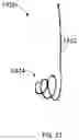 Fig. 22 - Systems, apparatus, and methods for placing a guidewire for a gastrostomy tube
