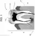 Fig. 02 - Bleeding control device and method of manufacture and use