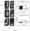 Fig. 07 - INHIBITORS OF GLYCOSPHINGOLIPID SYNTHESIS AND METHODS OF USE