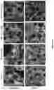 Fig. 49 - Novel Systems And Methods For The Therapeutic Use of Cannabinoids or Cannabinoid Analogs to Increase The Lipid Order of Cholesterol Containing Cell Membranes