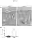 Fig. 07 - COMPOSITIONS AND METHODS FOR PREVENTING AND/OR REDUCING ISCHEMIA AFTER SURGICAL INCISIONS