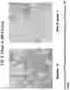Fig. 09 - COMPOSITIONS AND METHODS FOR TREATING MYELOFIBROSIS
