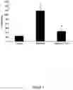 Fig. 02 - Methods of treating eye diseases associated with inflammation and vascular proliferation