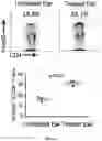 Fig. 02 - Compositions and methods for suppressing or reducing systemic immune response in a subject