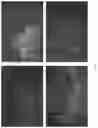 Fig. 02 - METHODS AND COMPOSITIONS FOR PROTECTION OF CELLS AND TISSUES FROM COMPUTED TOMOGRAPHY RADIATION