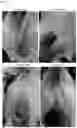Fig. 06 - Pharmaceutical composition for dermatology and uses thereof