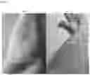 Fig. 09 - Pharmaceutical composition for dermatology and uses thereof