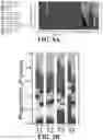 Fig. 07 - Microbiome-based informed method to formulate live biotherapeutics