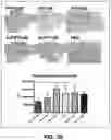 Fig. 32 - COMPOSITIONS AND METHODS FOR TREATMENT OF INTRACELLULAR DAMAGE AND BACTERIAL INFECTION