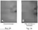 Fig. 02 - Stem cell stimulating compositions for treatment of melasma