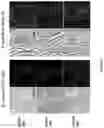 Fig. 16 - Endolysins active against bacteria, pharmaceutical compositions, and methods relating thereto