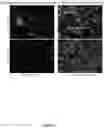Fig. 09 - ANC80 ENCODING SPHINGOLIPID-METABOLIZING PROTEINS