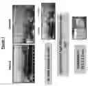 Fig. 08 - BIO-IMAGING PROBES AND METHODS FOR NON-INVASIVE DETECTION OF HUMAN UTERINE SARCOMAS