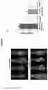 Fig. 09 - BIO-IMAGING PROBES AND METHODS FOR NON-INVASIVE DETECTION OF HUMAN UTERINE SARCOMAS