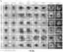 Fig. 08 - Biofunctional hydrogel for wound healing