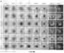 Fig. 09 - Biofunctional hydrogel for wound healing