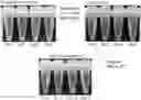 Fig. 01 - Microgel composition comprising collagen and method of preparing the same