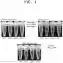 Fig. 02 - Microgel composition comprising collagen and method of preparing the same