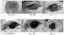 Fig. 04 - Composition of corneal implantation, and the use and preparation method thereof