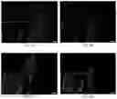 Fig. 07 - Composition of corneal implantation, and the use and preparation method thereof