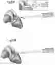 Fig. 07 - Optimized solid substrates, tools for use with same and uses thereof for promoting cell and tissue growth